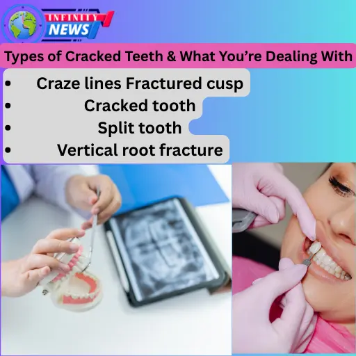 how to fix a cracked tooth naturally
