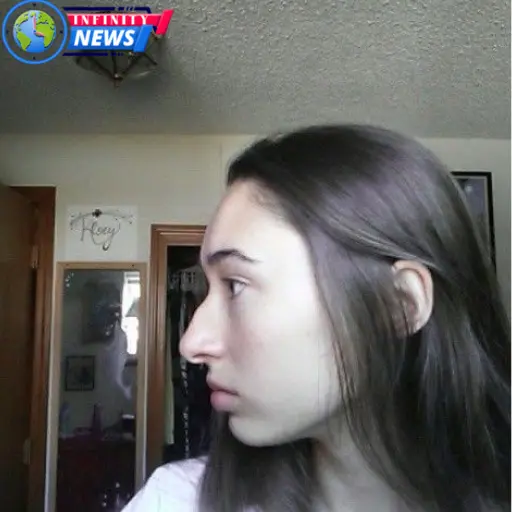what is a hooked nose