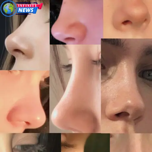 why do black people have big noses